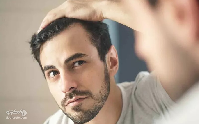 پروتز مو چیست؟ بهترین روش برای رفع طاسی سر و ترمیم مو