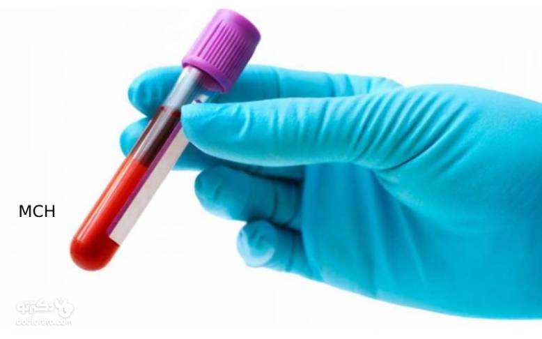 MCH در آزمایش خون و هر آنچه که باید درباره‌ MCH و تفسیر آن در آزمایش خون بدانیم