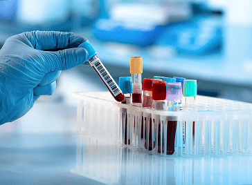 پذیرش آنلاین آزمایشگاه