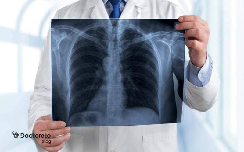 با بیماری ذات الریه یا پنومونی ریه آشنا شوید