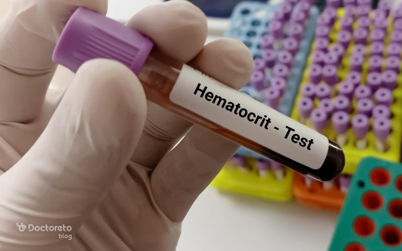 HCT در آزمایش خون چیست؟ هماتوکریت (hematocrit) پایین و بالا چقدر است؟