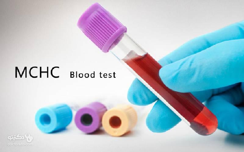 mchc در آزمایش خون چیست؟ بالا و پایین بودن m.c.h.c در آزمایش خون