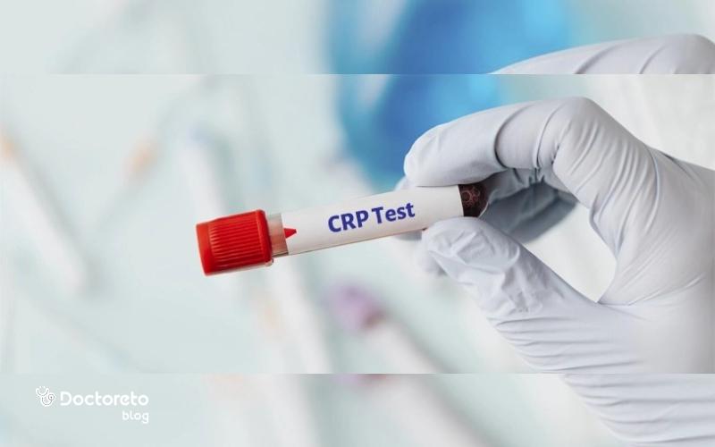 آزمایش crp چیست و تفسیر عدد نرمال آزمایش crp چگونه است؟