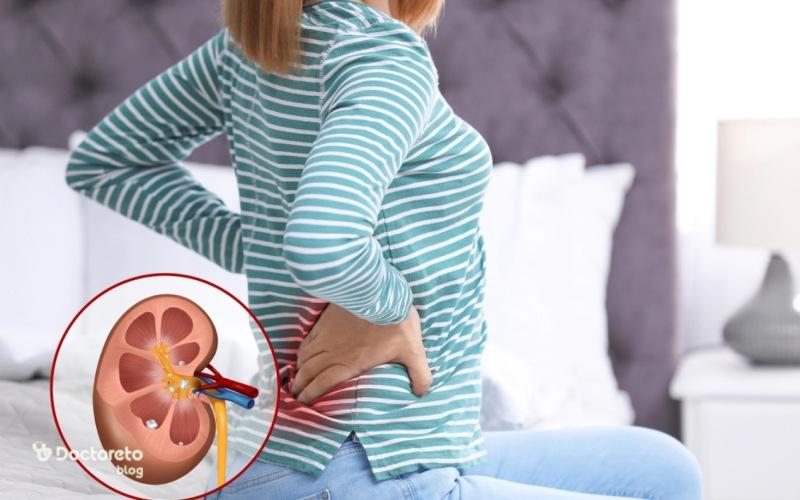 درد کلیه چگونه است؟ روش تشخیص و درمان آن