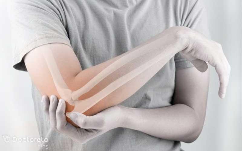تاندونیت را چطور تشخیص دهیم و درمان کنیم؟