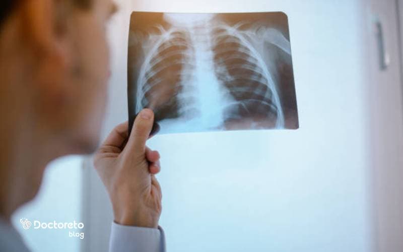 چرا باید عفونت ریه و درمان آن را جدی گرفت؟