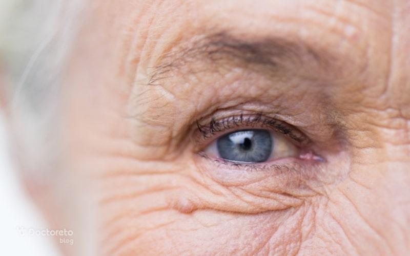 آیا برق زدن چشم بعد از عمل آب مروارید نشانه خطرناکی است؟
