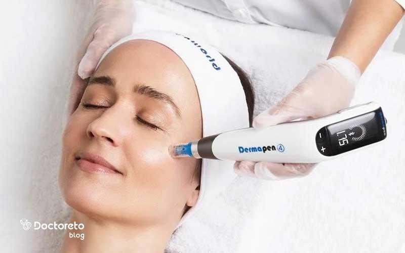 آر اف بهتر است یا میکرونیدلینگ؟