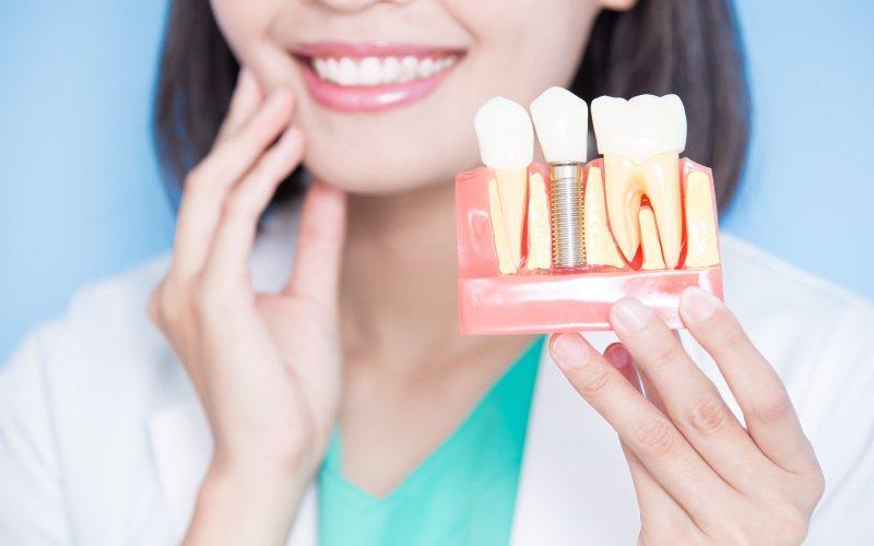 دندان چسبی بهتر است یا ایمپلنت؟