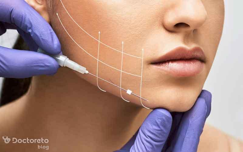 میزان تاثیرگذاری لیفت با نخ چقدر است؟