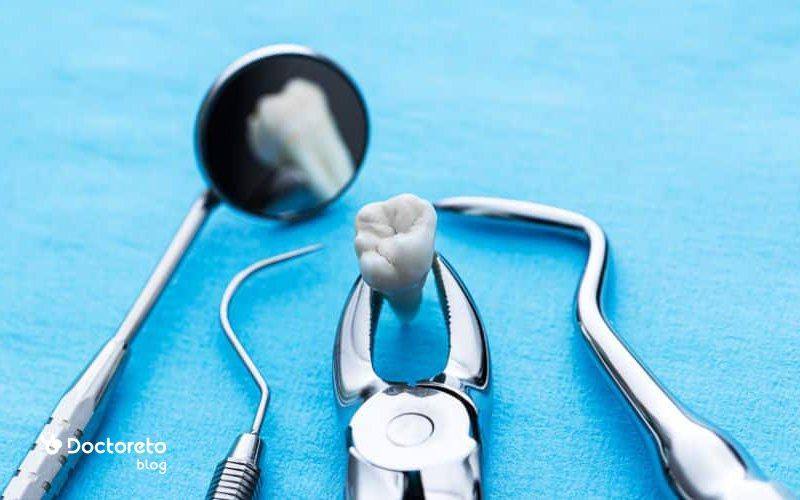 همه چیز درباره کشیدن دندان ؛ از آمادگی تا مراقبت های بعد آن