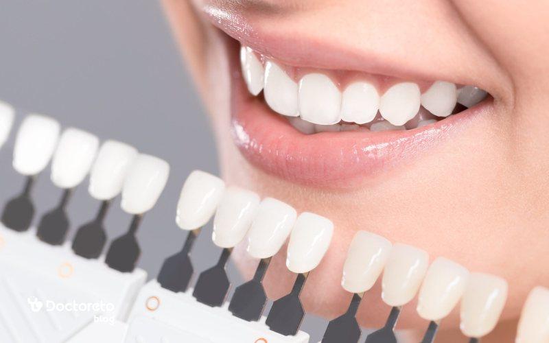 آیا میشود رنگ روکش دندان را تغییر داد؟