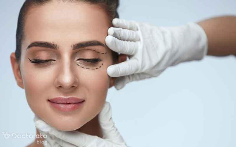 بلفاروپلاستی پلک پایین تا چه اندازه روی تغییر چهره موثر است؟