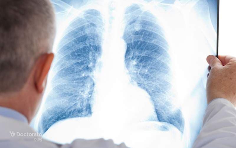 بهترین روش های پاکسازی ریه از عفونت چه هستند؟