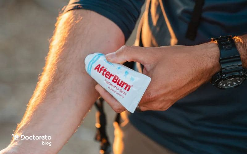 معرفی بهترین پمادهای سوختگی