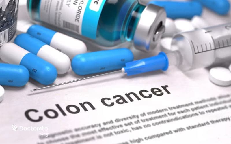 بررسی لیست داروهای سرطان روده بزرگ