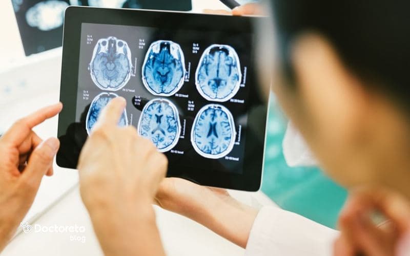 عکس تومور مغزی بدخیم