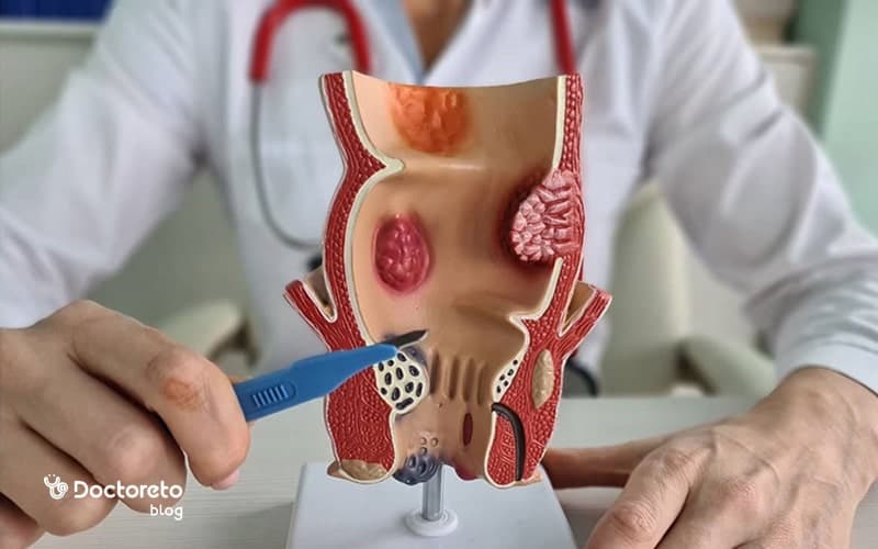 لیست تمامی علائم فیستول مویی