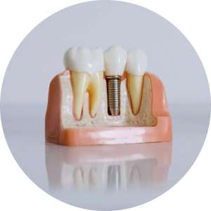 پروتز‌های دندانی