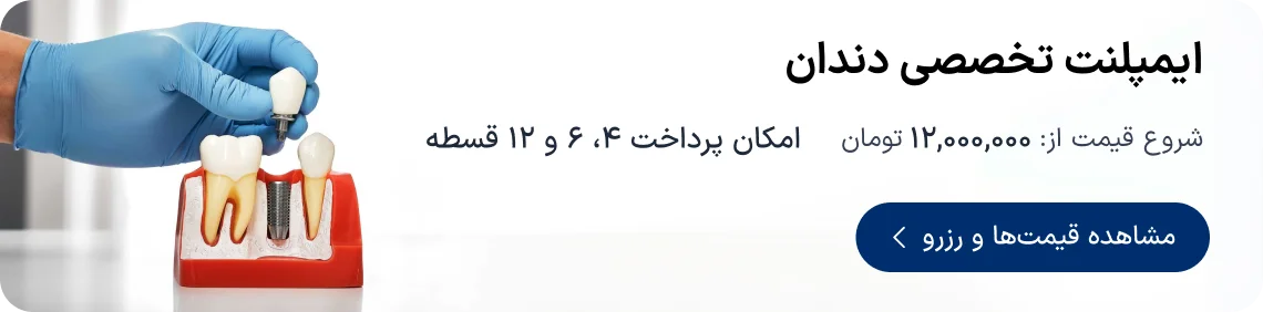 نوبت‌دهی و شرایط اقساطی ایمپلنت دندان در دکترتو