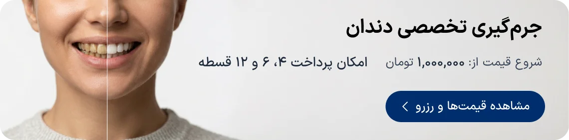 تخفیف و نوبت‌دهی جرمگیری دندان دکترتو
