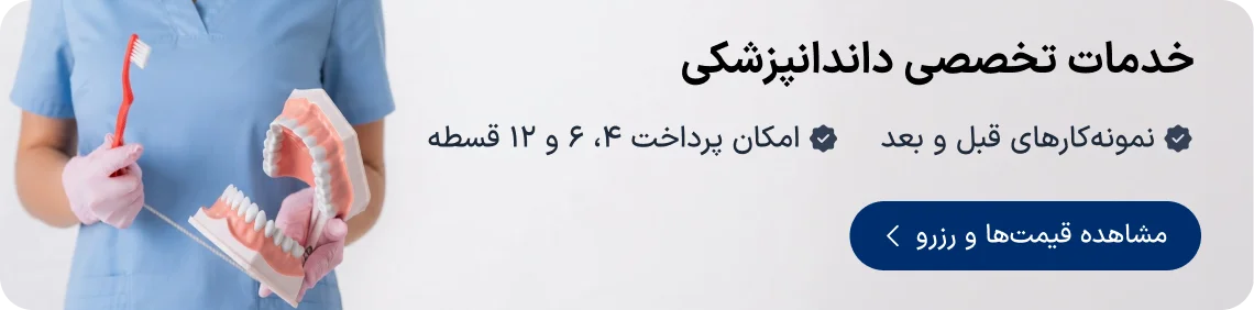 طرح اقساطی ایمپلنت و خدمات دندانپزشکی دکترتو