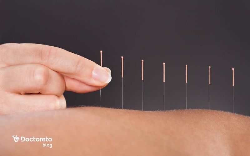 طب سوزنی؛ کاربرد، مزایا و معایب طب سوزنی