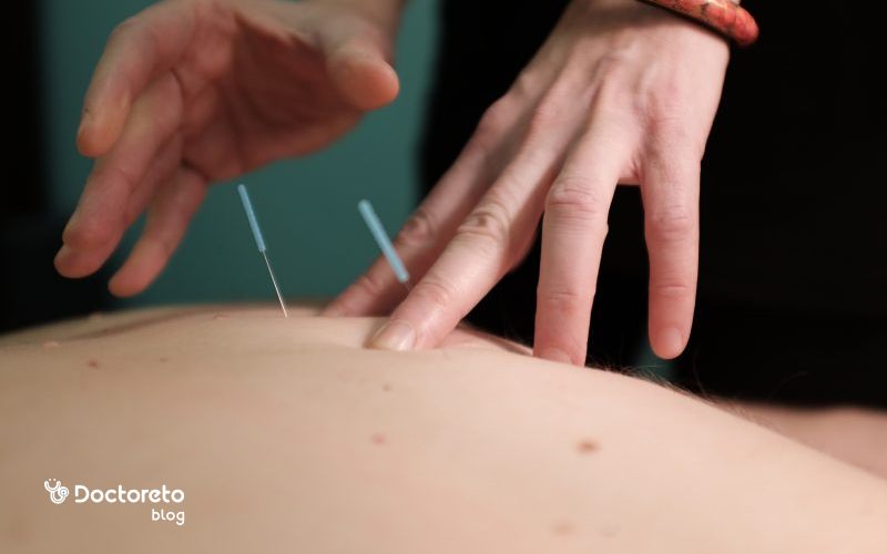 طب سوزنی برای لاغری