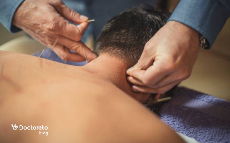 طب سوزنی و استرس