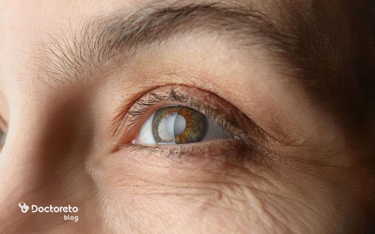 علائم آب مروارید چیست؟ برسی جامع نشانه ها از رایج ترین تا خطرناک ترین