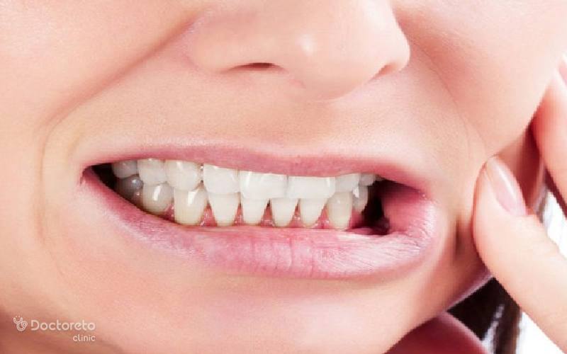 علائم دندان قروچه چیست و چه درمانی دارد؟