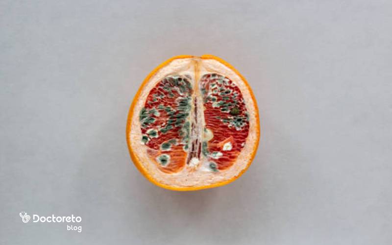 درمان خانگی بوی بد واژن