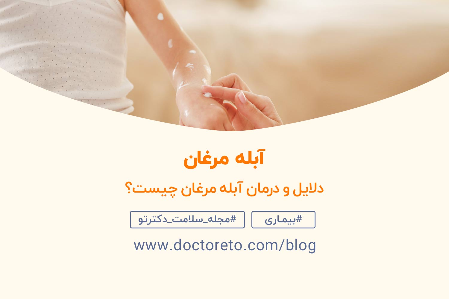 علائم آبله مرغان چیست و چه درمانی دارد مجله سلامت دکترتو