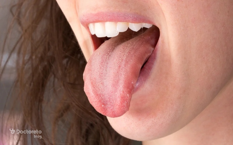 سندروم سوزش دهان، علائم و روش درمان آن