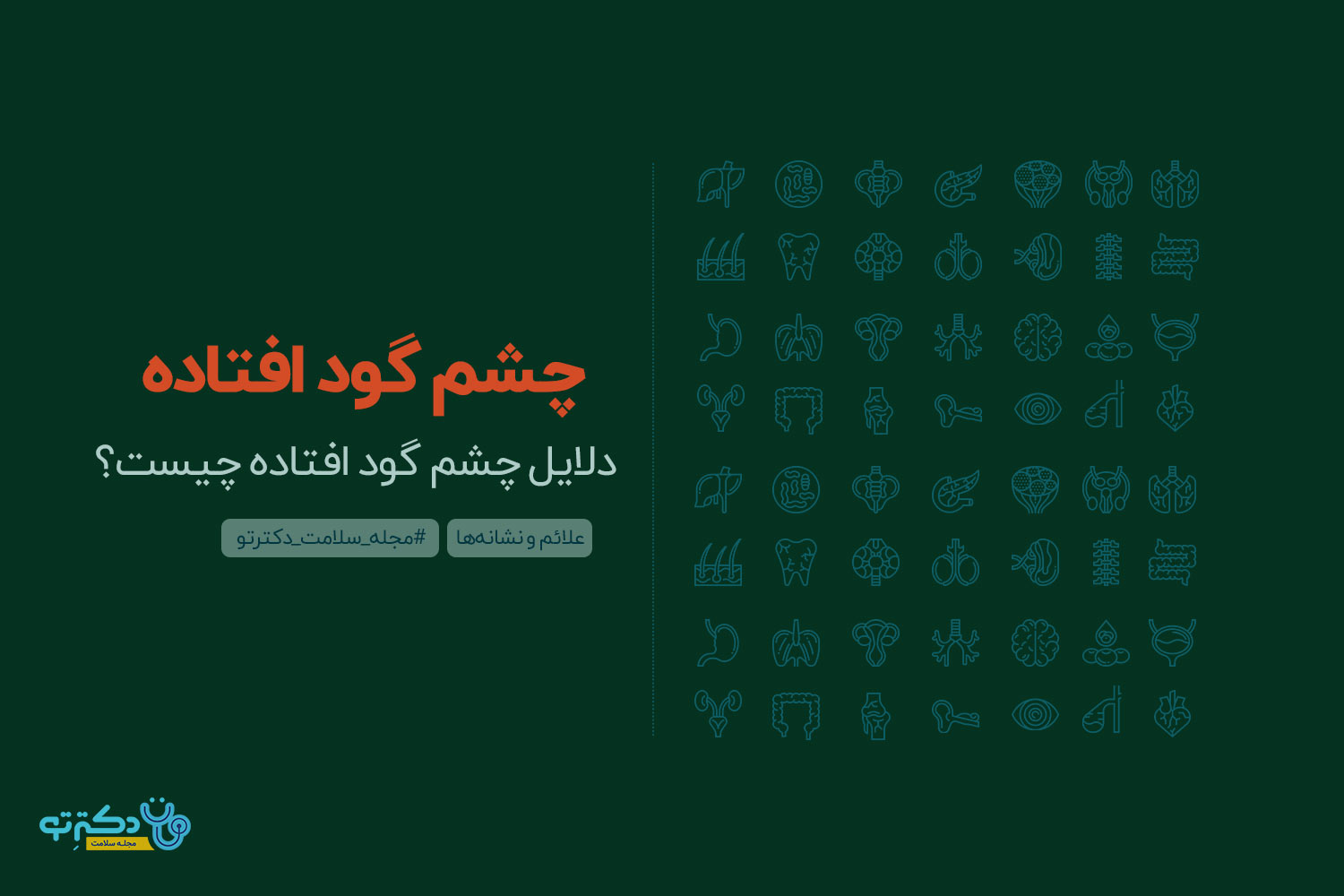 cheshm-gowd-oftadeh چشم گود افتاده