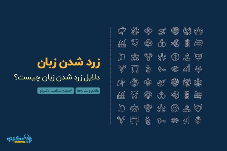 دلایل زرد شدن زبان چیست؟ زردی زبان چه درمانی دارد؟