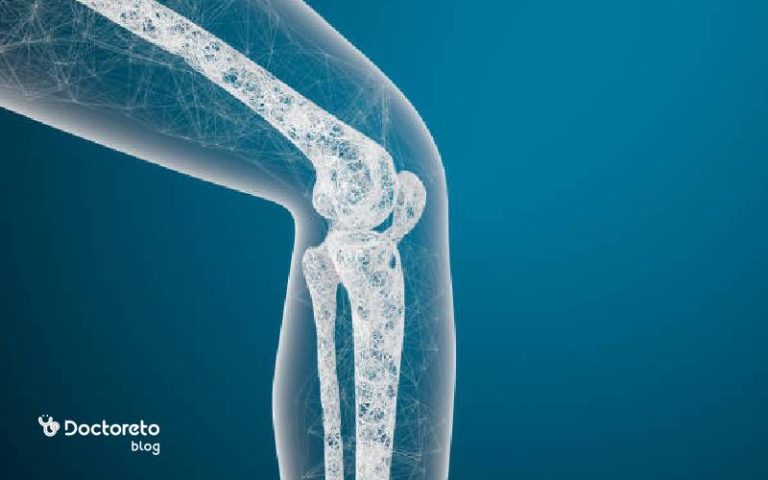 همه چیز در مورد پوکی استخوان یا استئوپروزیس