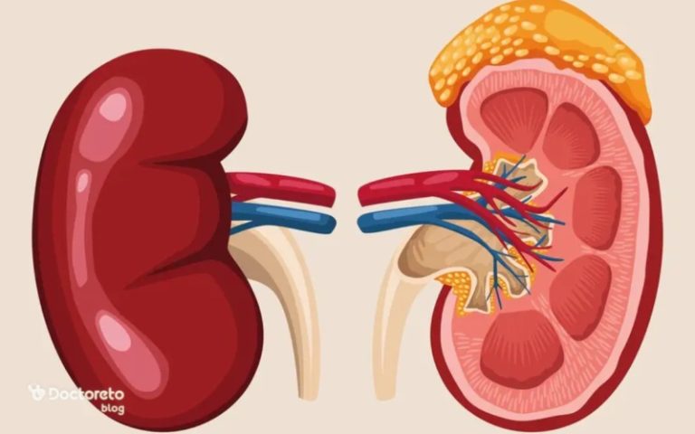 بیماری فئوکروموسیتوم چیست و چگونه ایجاد میشود؟