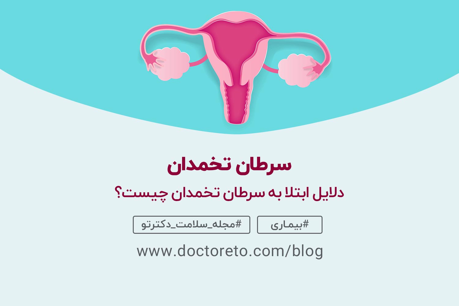 علائم خطرناک سرطان تخمدان را بشناسید و با مراجعه به دکتر زنان جلوی خطر