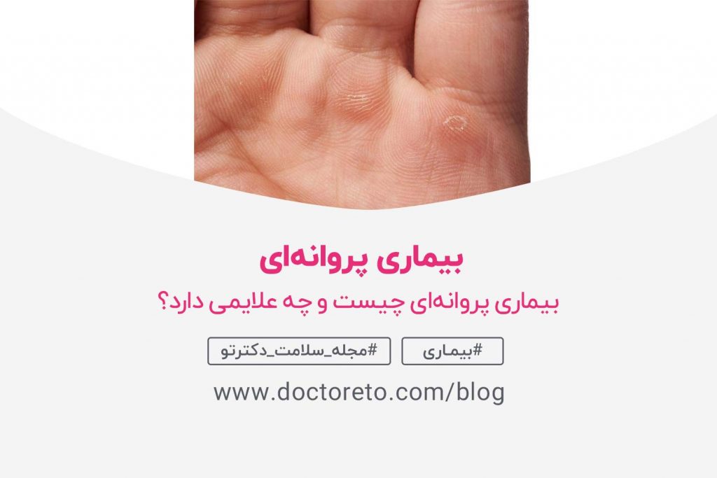 بیماری پروانهای چیست و چه علایمی دارد؟