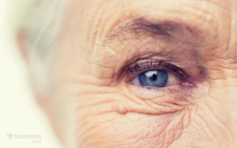دژنراسیون شبکیه چشم یا رسوب شبکیه چشم چیست؟