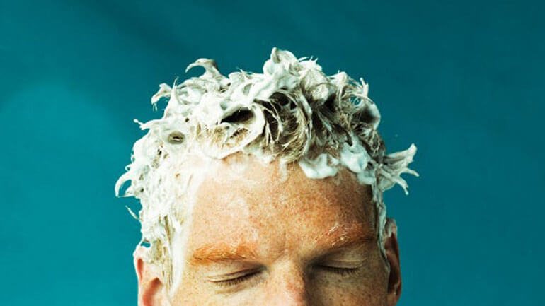 greasy hair treatment