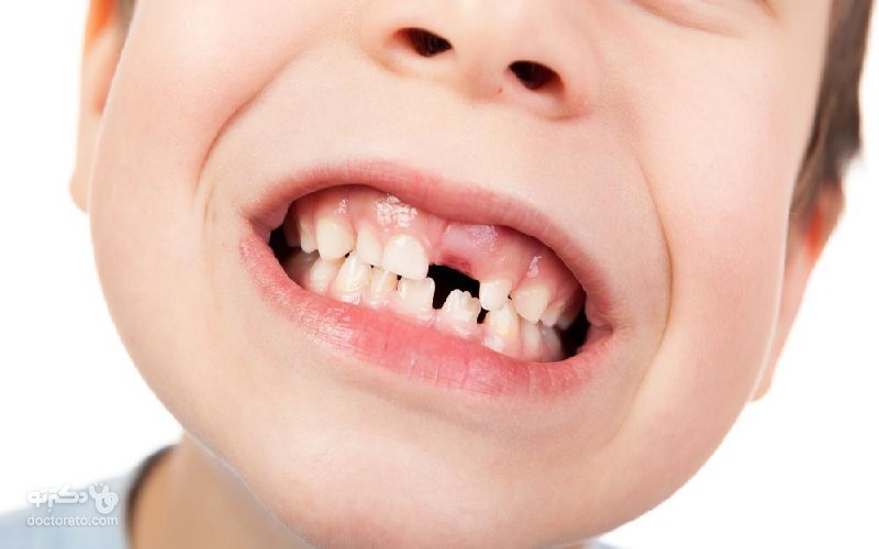 تب دندان در آوردن در کودکان
