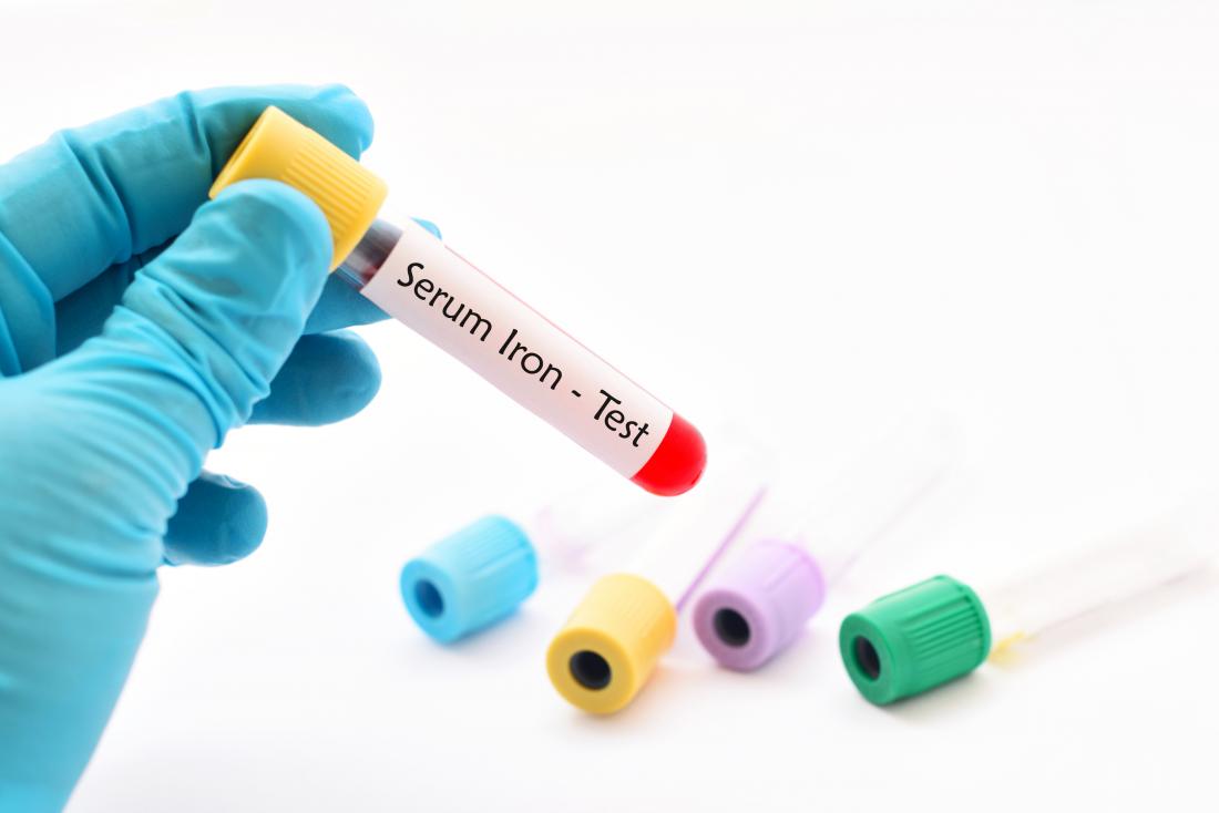 serum-iron-blood-test