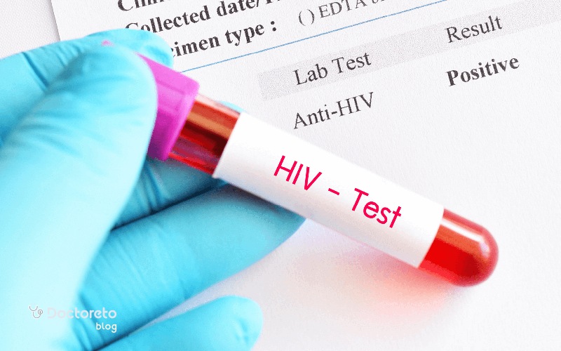 آزمایش ایدز چیست؟