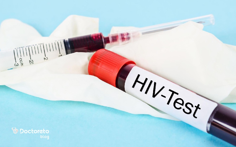 تست آنتی بادی HIV