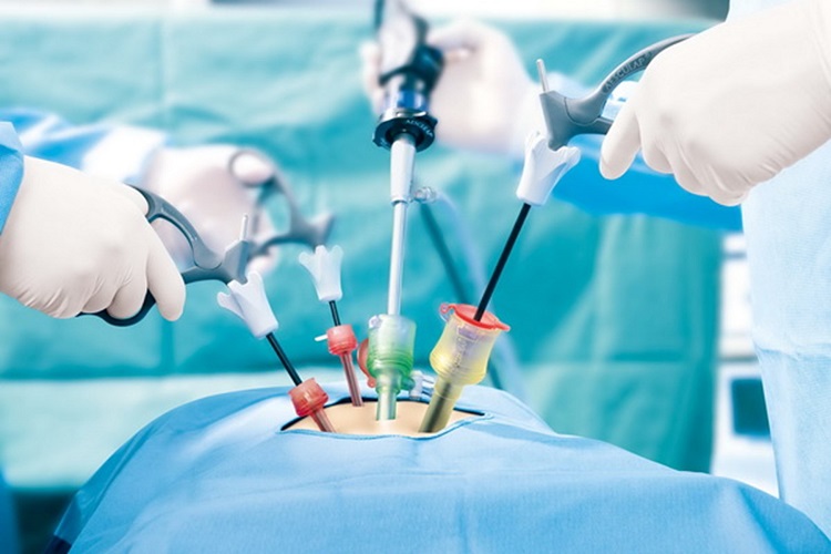 Surgery-for-infertility