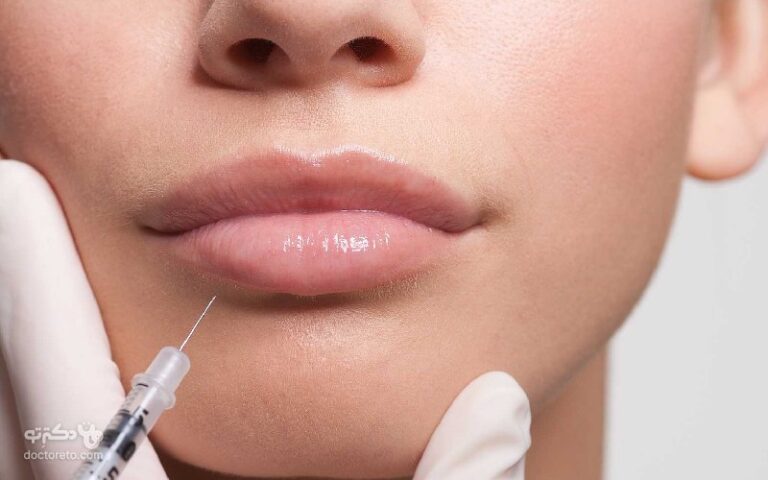 تزریق ژل لب، بررسی انواع برندها و عوارض ژل لب