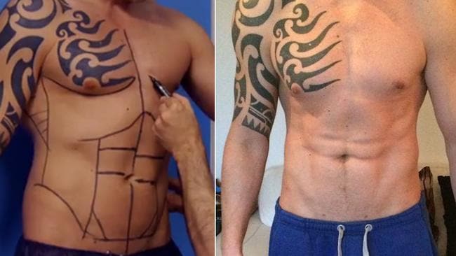 Abdominal-Etching
