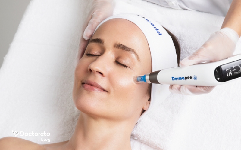 میکرونیدلینگ برای چه افرادی مناسب است؟